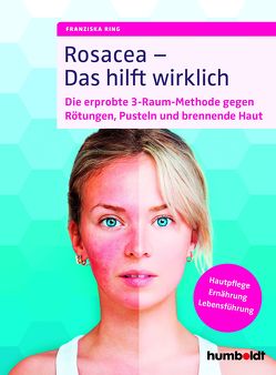 Rosacea – Das hilft wirklich von Ring,  Franziska