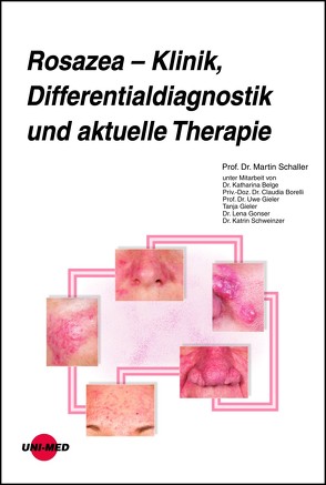 Rosazea – Klinik, Differentialdiagnostik und aktuelle Therapie von Schaller,  Martin