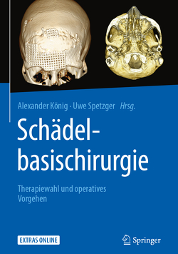 Schädelbasischirurgie von Koenig,  Alexander, Spetzger,  Uwe