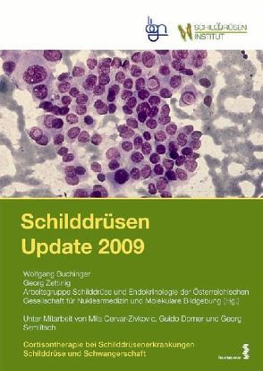 Schilddrüsen Update 2009:  (1) Schilddrüse und Schwangerschaft –  (2) Cortisontherapie bei Schilddrüsenerkrankungen von Buchinger,  Wolfgang, Cervar-Zivkovic,  Mila, Dorner,  Guido, Semlitsch,  Georg, Zettinig,  Georg