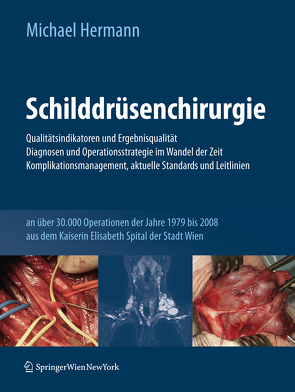 Schilddrüsenchirurgie – Qualitätsindikatoren und Ergebnisqualität, Diagnosen und Operationsstrategie im Wandel der Zeit, Komplikationsmanagement, aktuelle Standards und Leitlinien von Hermann,  Michael