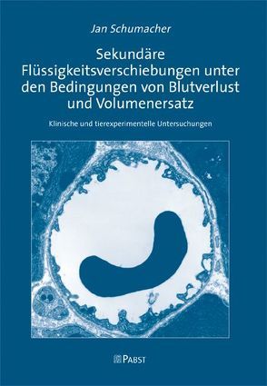 Sekundäre Flüssigkeitsverschiebungen unter den Bedingungen von Blutverlust und Volumenersatz von Schumacher,  Jan