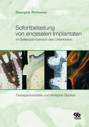 Sofortbelastung von enossalen Implantaten im Seitenzahnbereich des Unterkiefers von Romanos,  Georgios E