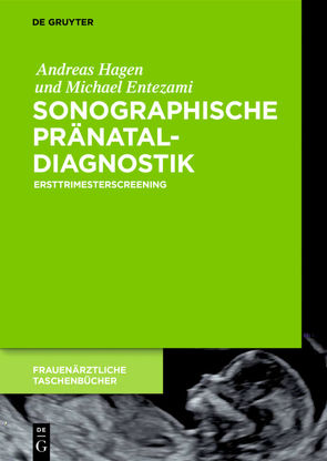 Sonographische Pränataldiagnostik von Entezami,  Michael, Hagen,  Andreas