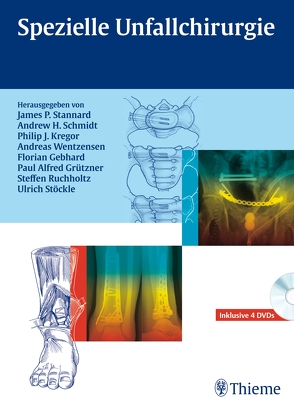 Spezielle Unfallchirurgie von Gebhard,  Florian, Grützner,  Paul Alfred, Kregor,  Philip J., Ruchholtz,  Steffen, Schmidt,  Andrew H., Stannard,  James P, Stöckle,  Ulrich, Wentzensen,  Andreas