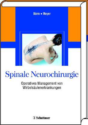 Spinale Neurochirurgie von Börm,  Wolfgang, Meyer,  Frerk