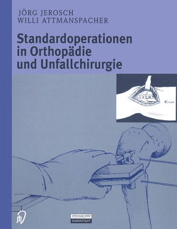 Standardoperationen in Orthopädie und Unfallchirurgie von Attmanspacher,  W., Jerosch,  J., Maronna,  U., Stedtfeld,  H.-W.