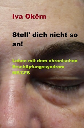 Stell dich nicht so an! Leben mit dem chronischen Erschöpfungssyndrom ME /CFS von Okërn,  Iva