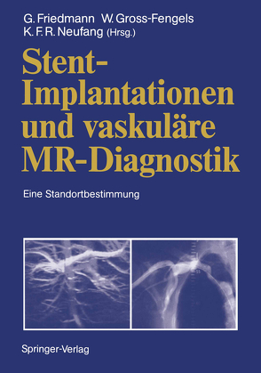 Stent-Implantationen und vaskuläre MR-Diagnostik von Bunke,  J., Friedmann,  Gerd, Gross-Fengels,  W., Gross-Fengels,  Walter, Heindel,  W., Höpp,  H.W., Jaschke,  W., Jungehülsing,  M., Koch,  M., Krestin,  G.P., Krug,  B, Kuhn,  F.-P., Neufang,  K.F.R., Neufang,  Karl F.R., Palmaz,  J.C., Richter,  G.M., Schild,  H., Stock,  K.W., Theissen,  P., Vorwerk,  D., Zeitler,  E., Zollikofer,  C.L.