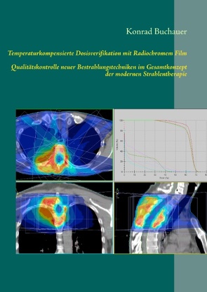 Temperaturkompensierte Dosisverifikation mit Radiochromem Film von Buchauer,  Konrad