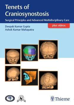 Tenets of Craniosynostosis von Gupta,  Deepak, Mahapatra,  Ashok