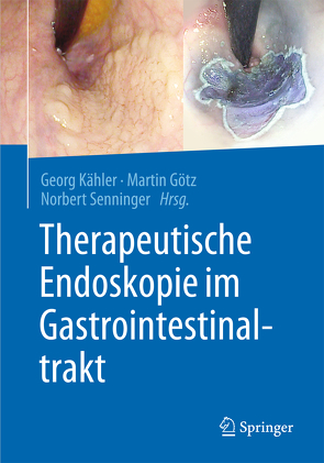 Therapeutische Endoskopie im Gastrointestinaltrakt von Goetz,  Martin, Kähler,  Georg, Senninger,  Norbert