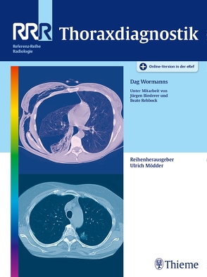 Thoraxdiagnostik von Biederer,  Jürgen, Rehbock,  Beate, Wormanns,  Dag