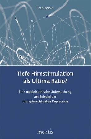 Tiefe Hirnstimulation als Ultima Ratio? von Beeker,  Timo