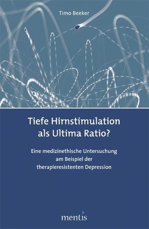 Tiefe Hirnstimulation als Ultima Ratio? von Beeker,  Timo