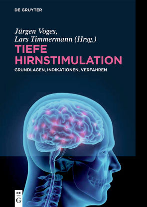 Tiefe Hirnstimulation von Timmermann,  Lars, Voges,  Jürgen