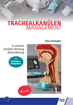 Trachealkanülenmanagement von Schwegler,  Hans