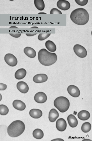 Transfusionen von Lauper,  Anja