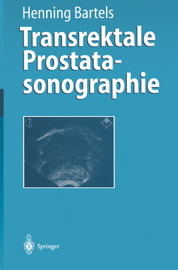 Transrektale Prostatasonographie von Bartels,  Henning