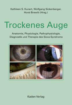 Trockenes Auge von Brewitt,  Horst, Kunert,  Kathleen S., Sickenberger,  Wolfgang