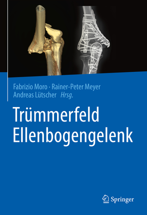 Trümmerfeld Ellenbogengelenk von Lütscher,  Andreas, Meyer,  Rainer-Peter, Moro,  Fabrizio