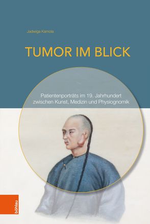 Tumor im Blick von Kamola,  Jadwiga