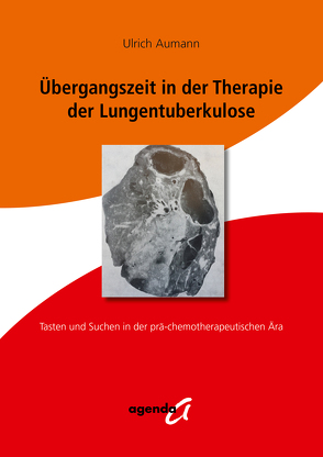 Übergangszeit in der Therapie der Lungentuberkulose von Aumann,  Ulrich