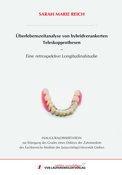 Überlebenszeitanalyse von hybridverankerten Teleskopprothesen – Eine retrospektive Longitudinalstudie von Reich,  Sarah Marie