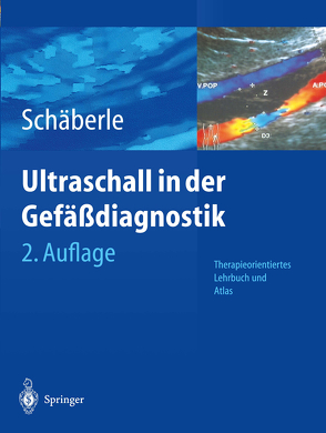 Ultraschall in der Gefäßdiagnostik von Schäberle,  Wilhelm