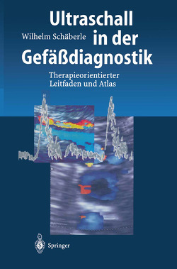 Ultraschall in der Gefäßdiagnostik von Schäberle,  Wilhelm