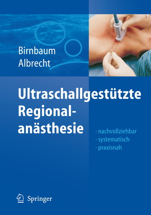 Ultraschallgestützte Regionalanästhesie von Albrecht,  Roland, Birnbaum,  Jürgen