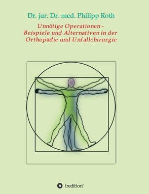 Unnötige Operationen – Beispiele und Alternativen in der Orthopädie und Unfallchirurgie von Roth,  Dr. jur. Dr. med. Philipp