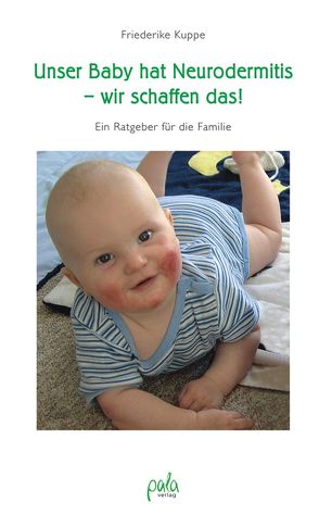 Unser Baby hat Neurodermitis – wir schaffen das! von Kuppe,  Friederike, Kuppe,  Konstantin