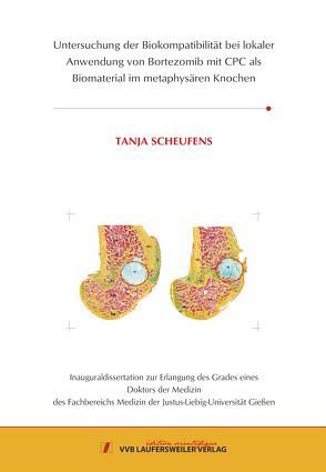 Untersuchung der Biokompatibilität bei lokaler Anwendungvon Bortezomib mit CPC als Biomaterialim metaphysären Knochen von Scheufens,  Tanja