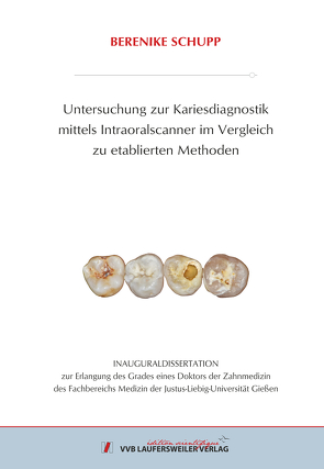 Untersuchung zur Kariesdiagnostik Mittels Intraoralscanner im Vergleich zu Etablierten Methoden von Schupp,  Berenike