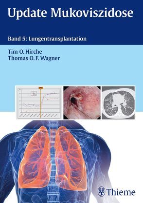 Update Mukoviszidose, Band 5 von Hirche,  Tim O., Wagner,  Thomas O. F.