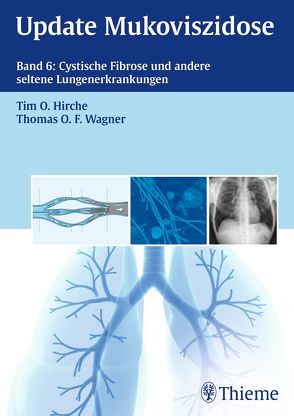 Update Mukoviszidose, Band 6 von Hirche,  Tim O., Wagner,  Thomas O. F.