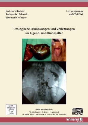 Urologische Erkrankungen und Verletzungen im Jugend- und Kindesalter von Bichler,  Karl-Horst, Blenk,  Holger, Böhmer,  Angela, Mattauch,  Walter, Prochazka,  Heinz, Schaefer,  Hans-Eckard, Schmidt,  Andreas M., Shen,  Ruijun, Vielhauer,  Eberhard, Wechsel,  Hans-Wilhelm