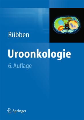 Uroonkologie von Rübben,  Herbert