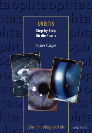 Uveitis von Klaeger,  Andres