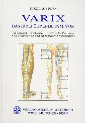 VARIX – Das Irreführende Symptom von Popa,  Nikolaus, Wolfertsberger,  Peter