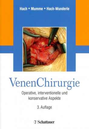 Venen Chirurgie von Hach,  Wolfgang, Hach-Wunderle,  Viola, Mumme,  Achim