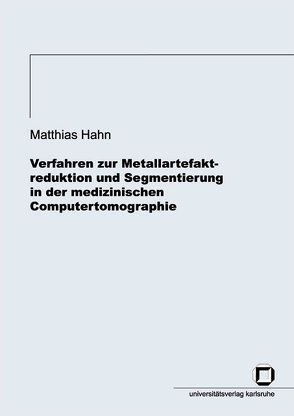 Verfahren zur Metallartefaktreduktion und Segmentierung in der medizinischen Computertomographie von Hahn,  Matthias