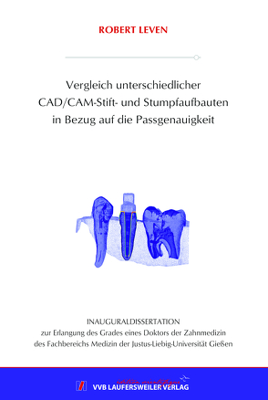 Vergleich unterschiedlicher CAD/CAM-Stift- und Stumpfaufbauten in Bezug auf die Passgenauigkeit von Leven,  Robert