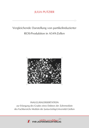 Vergleichende Darstellung von partikelinduzierter ROS-Produktion in A549-Zellen von Putzier,  Julia