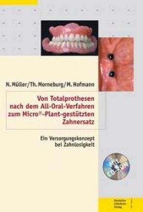 Von Totalprothesen nach dem All-Oral-Verfahren zum Micro©-Plant-gestützten Zahnersatz von Hofmann,  Manfred, Morneburg,  Thomas, Müller,  Norbert