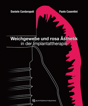 Weichgewebe und rosa Ästhetik in der Implantattherapie von Cardaropoli,  Daniele, Casentini,  Paolo