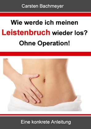 Wie werde ich meinen Leistenbruch wieder los? Ohne Operation! von Bachmeyer,  Carsten