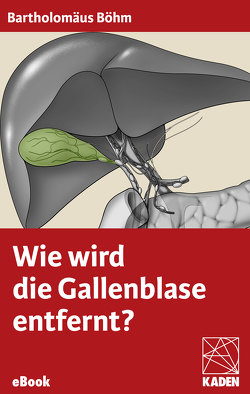 Wie wird die Gallenblase entfernt? von Böhm,  Bartholomäus