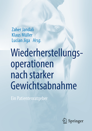 Wiederherstellungsoperationen nach starker Gewichtsabnahme von Jandali,  Zaher, Jiga,  Lucian, Mueller,  Klaus